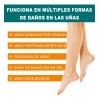Crema Para Eliminar Hongos En Uñas De Manos , Pies