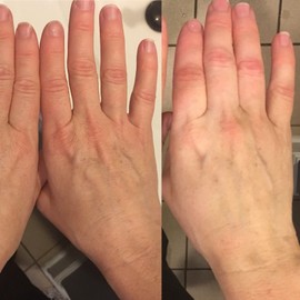 Sherlon Salon Hair &amp; Skin Care First Step Black Soap Body Wash for Eczema and Sensitive Dry & Oily Skin