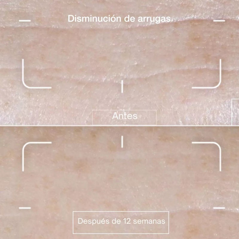 Biotiks Crema Facial Hidratante Con Ácido Hialurónico Antiarrugas