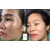 Retinol Venature Bakuchiol Retinol Rejuvenation Serum- 30ml