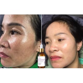 Retinol Venature Bakuchiol Retinol Rejuvenation Serum- 30ml