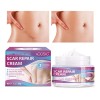 Scar Crema Vogsig Cicatrices Quirúrgicas Acné Quemaduras