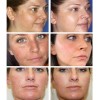 Crema Quitamanchas Hidratante 20g Para Rostro Todo Tipo De Piel
