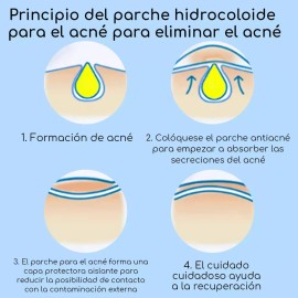2 Caja Parches Para Espinillas El Acn Granos Pimple Patch Invisibles Antiacn 64pz Hidrocoloides Para Acne Pimple Patch Para Todos Los Tipos De Piel   
