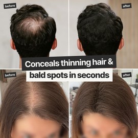 IMPERIO IMPERIO Hair Building Fibers for Thinning Hair - 26g Premium Hair Fibers for Women & Men in Hairdresser Quality - Hair thickening in less than 20 seconds (Light Brown)