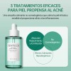 Skin1004 Ampolla Centella Madagascar Anti-acn Calmante