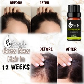 Rosemary Oil for Hair Growth by Salenda - 100% Pure Essential Oils, for Diffuser, Hair & Skin Care, Humidifiers - 0.34 Fl Oz (10 ml)