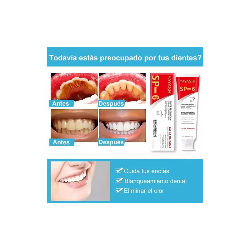 P-Paquete Dentales Blanqueadoras Probióticas Sp-6 De 2 Pastas