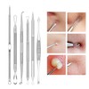 Blackhead Remover Comedone Extractor,15 Pcs Professional Stainless Steel Blackhead Remover