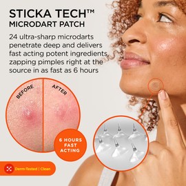 ZitSticka Killa Pimple Patches for Face - World's Most Potent Pimple Patch with Fast-Acting Microdarts - Starts Working within 6 Hours for Deep, Early-Stage Zits - Regular 8 Count with Cleana Swab