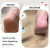 SCHMIERZEUG Callus Remover - Glass Callus File with Two Strengths