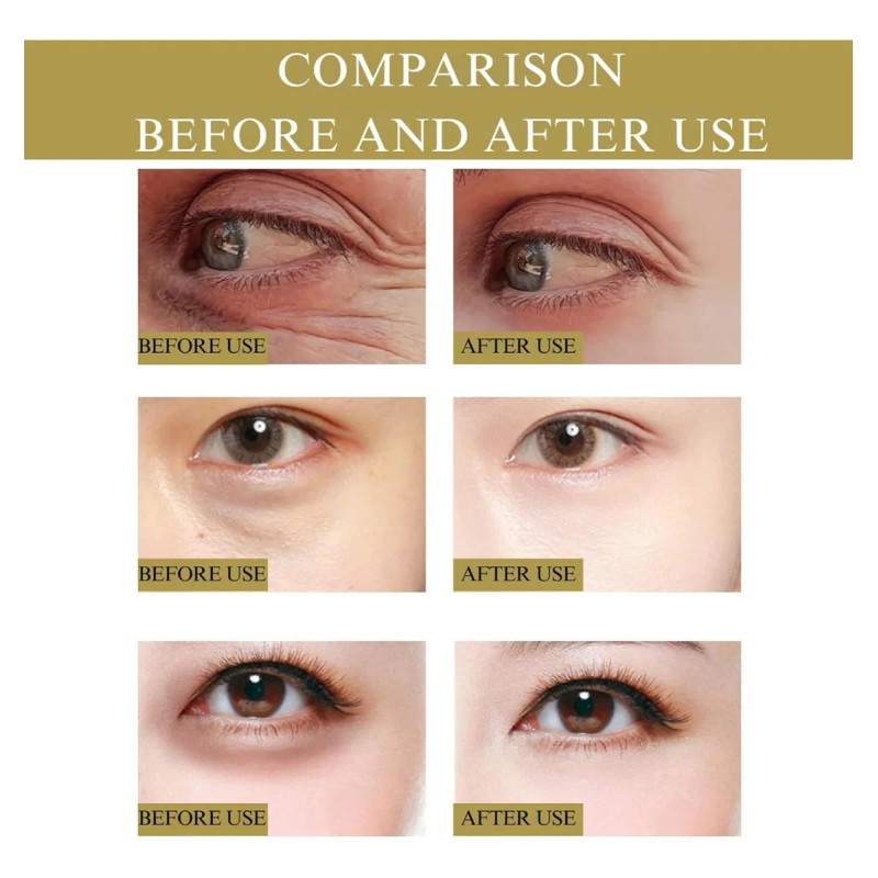 Parches Microagujas Nano Ojos