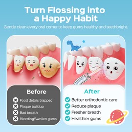 COSLUS Portable Water Flosser for Kids: 4 Gentle Modes for Ages 6+, Braces & Sensitive Teeth - with Fun DIY Stickers, 4 Storable Nozzles, Mini Compact for Home School & Travel Use, BPA-Free, Blue