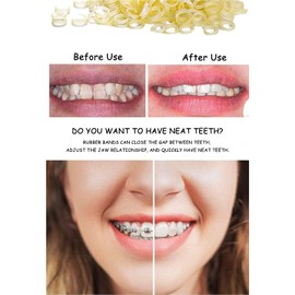 500 pcs Orthodontic Elastic Bands Dental Orthodontic Elastics Latex Rubber Bands (Rabbit 3/16")