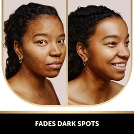 VALITIC Kojic Acid Soap for Hyperpigmentation - with Glutathione, Collagen & Vitamin C - Advanced Soap Bars with Turmeric - Original Japanese Complex for Dark Spot Correction - 2 Pack