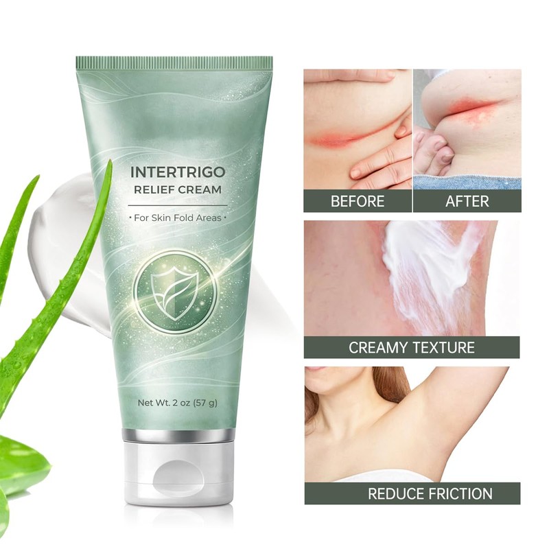 WenFeng Intertrigo Cream for Skin Folds & Chafing Support,2 Pack