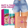 Hppsctink Butt Acne Cream, 100 ml Butt Acne Cream Reducing