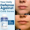Clear Probiotics Lysine Cold Sore Treatment for Lips – with