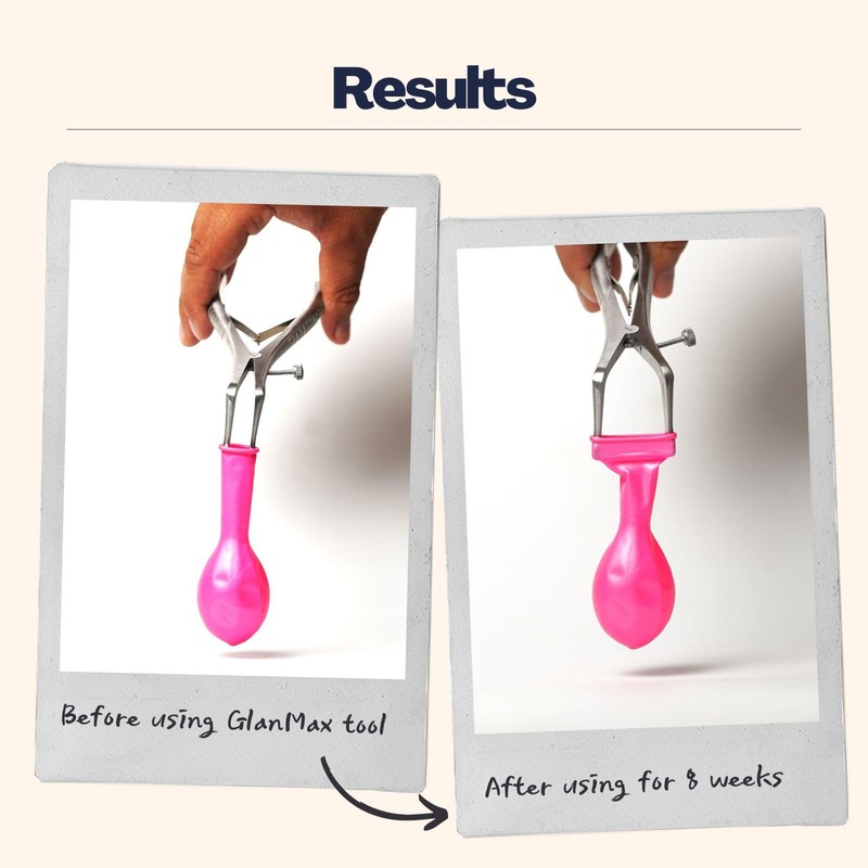GlanMax tool for phimosis | Phimosis Stretching tool | Opens
