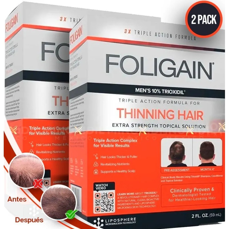 Trioxidil 10% de Foligain – Sérum para Control de Caída