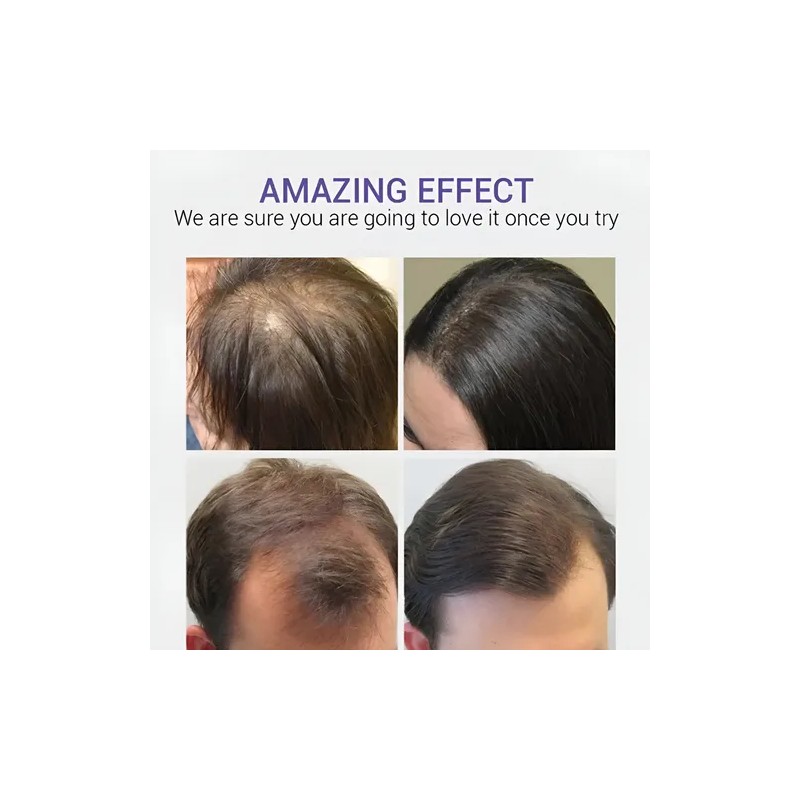 Tratamiento Regenerativo Cabello Calvicie Caida Natural 30ml