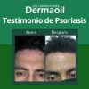 Kit Especial Para Psoriasis: Pomada, Jabón Y Crema.