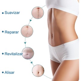 Parche de Silicona Médica para Cicatrices – Reutilizable y Efectivo en Cicatrices Nuevas o Antiguas, Quemaduras, Queloides, Estrías y Acné | 1 Pieza