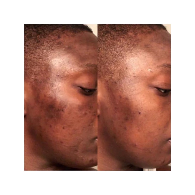 Gin Amber Beauty - Natural 20% Vitamin C Booster -