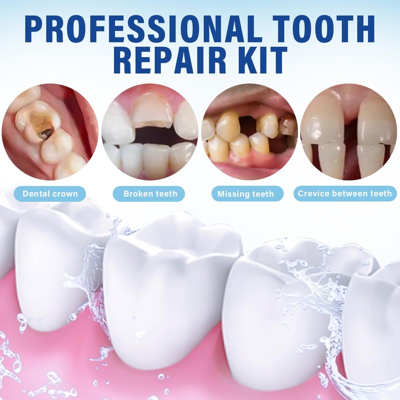 Tooth Filling Repair Kits, Temporary Tooth Repair Kit, for Broken