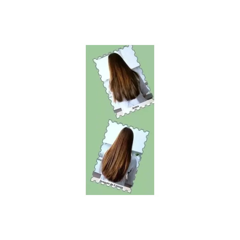 Shampoo Cola De Caballo, Crecimiento Sheló Nabel Cont 950 Ml