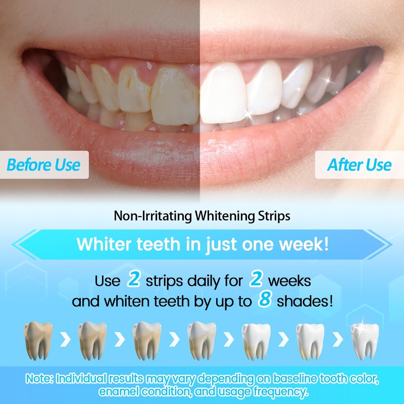 SURFOU Teeth Whitening Strips 28 Treatments(56 Strips), Non Peroxide, Safe