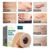 Silicone Scar Sheets (1.6” x 120” Roll-3M), Silicone Scar Tape