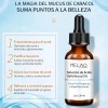 Serum Anti Acné Ácido Salicílico 2% Exfoliante Puntos Negros