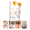 Crema Blanqueadora Para Partes Intimas, Aclarador De Axilas