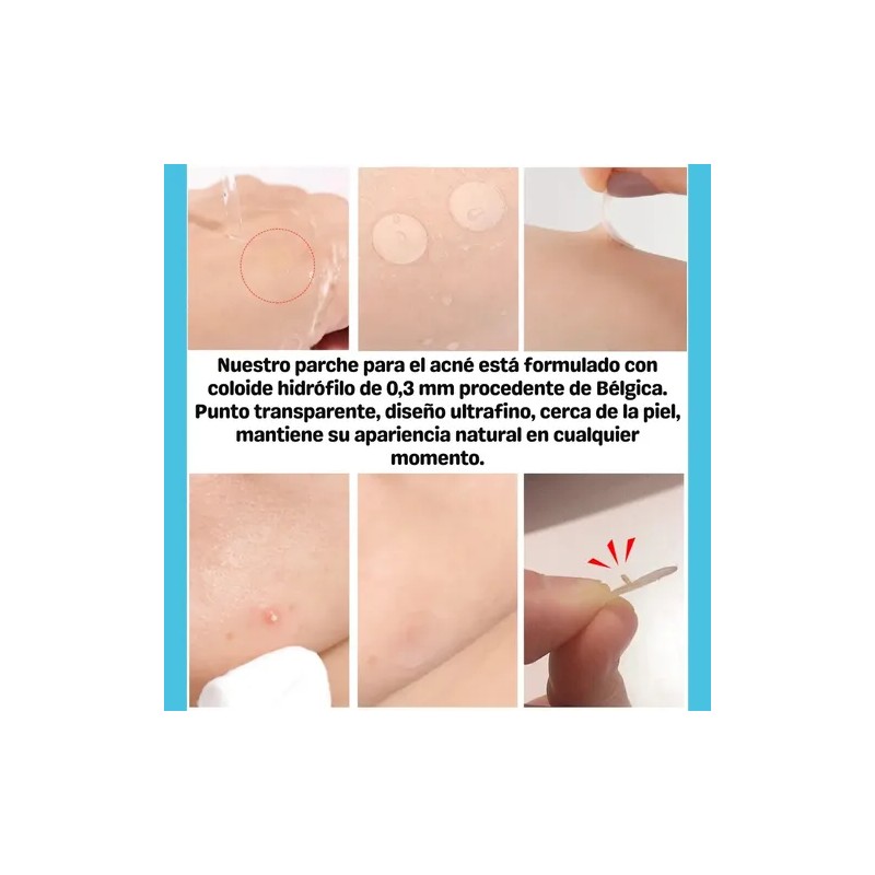 Parches Para Acne Elimina Espinillas Granos Facial Noche F