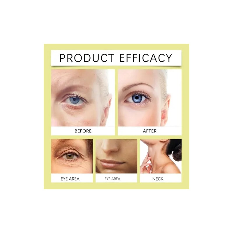 2026 [seleccin] 3 Celimax The Vita A Retinal Shot, Zj