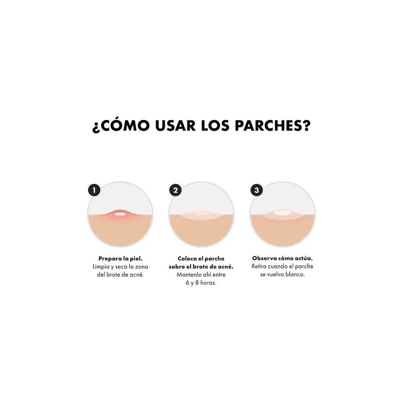P-Parches Faciales Para Acné x36 Piezas Hero Cosmetics