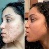 The Inkey List Gel Antimanchas Ácido Tranexámico 30ml Vegano Noche