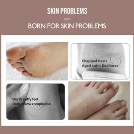 5 Pairs Shea Butter & Coconut Foot Peel Mask - Foot Peel Mask for Hard Skin - Deep Moisturising Socks - Repair Cracked Heels & Remove Dead Skin - Relaxes Foot Care Foot Masks Socks