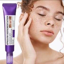 H-yperpigmentation Cream， Advanced Anti-Hyperpigmentation C-ream, Hyperpigmentation Treatment Cream， for Dark Spots, Age Spots, Sun Spots - Anti-Aging & Skin Firming Face Cream for All Skin Types