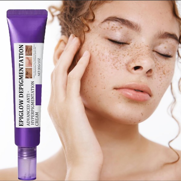H-yperpigmentation Cream， Advanced Anti-Hyperpigmentation C-ream, Hyperpigmentation Treatment Cream， for Dark