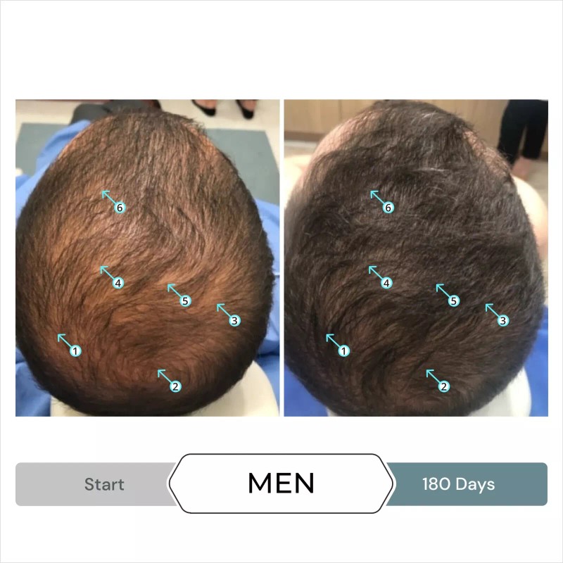 DS Laboratories Revita.SOD | Tablets For Hair Growth Support (Antioxidant