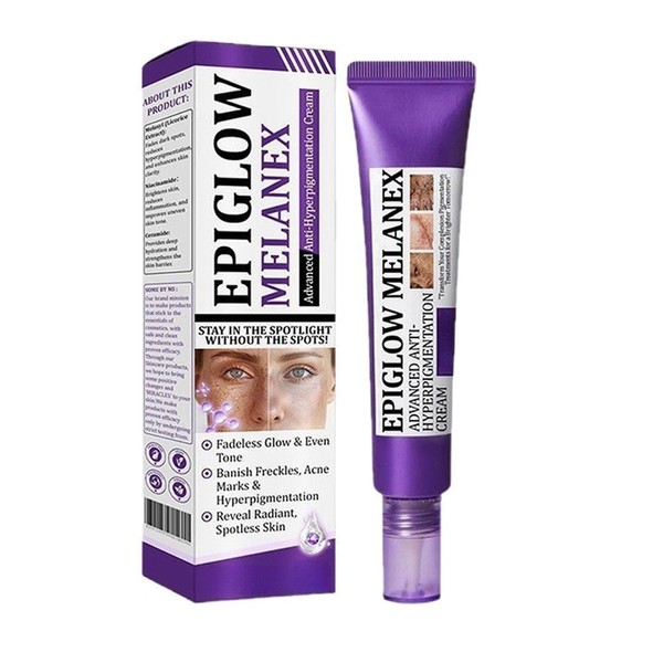 Spot Treatment Cream,Anti Pigmentation Face Cream,Pigmentation Removal Cream,Advanced Anti-Hyperpigmentation Crea-m