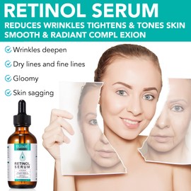 Retinol Serum Face with Retinol, Hyaluronic Acid and Vitamin E Radiant, Even Skin - Wrinkles Away Instant Effect, Skin Care 60 ml
