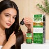 Aceite Esencial Romero Eelhoe Para Crecimiento Cap