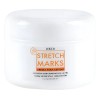 Crema Para Estrías