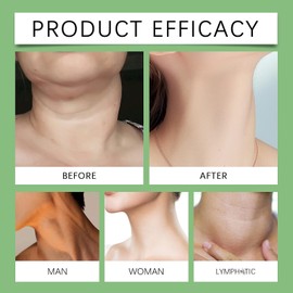 Lymp-Hatic De-tox Herbal Cream,Lymp-Hatic Drainage Cream,Body Cream Swollen Feet and Legs Treatm-Ent,Body Firming Cream,Body Moisturiser for Dry Skin,Lymp-hatic Drainage Massage,Body Massage Oil