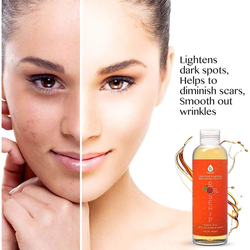 Pursonic Rosehip Oil for Face, Nails, Hair and Skin, 6