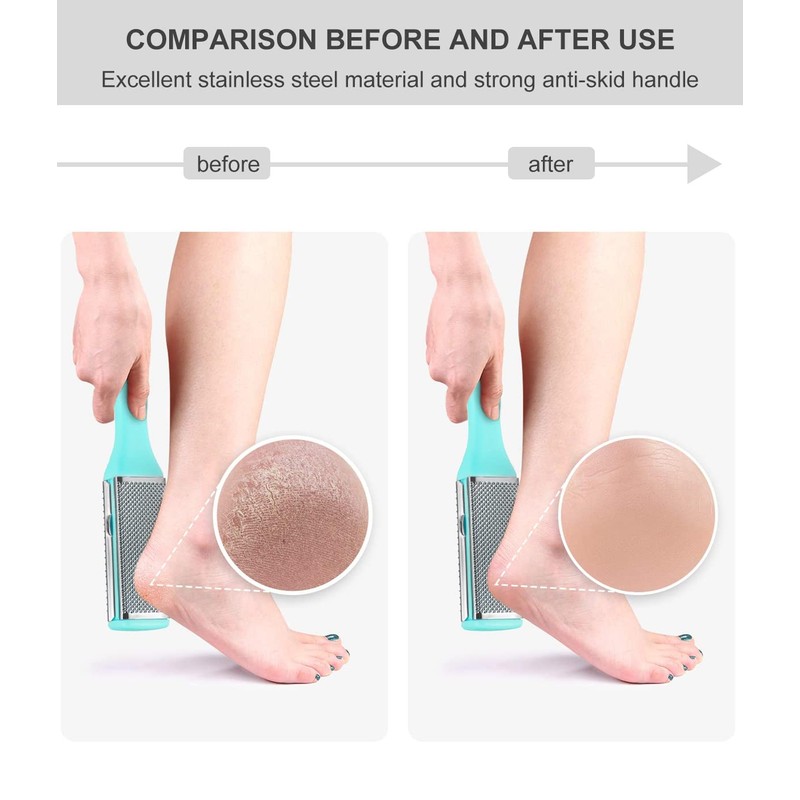 Clyhon Callus File Callus Remover Quick Callus Rasp Foot Care