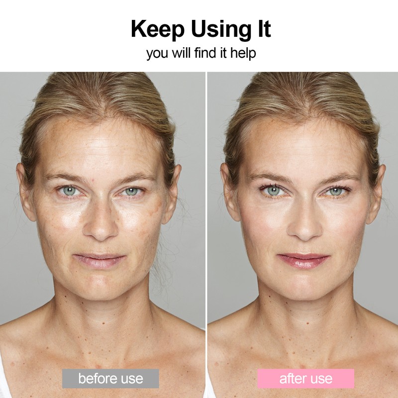 Face Wrinkle Remover Strips Reusable 11pcs Anti-Wrinkle Face Pads Silicone